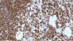 Anti-CD7 antibody [LP15] used in IHC (Paraffin sections) (IHC-P). GTX01945