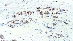 Anti-Mesothelin antibody [5B2] used in IHC (Paraffin sections) (IHC-P). GTX01948