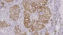 Anti-Wilms Tumor 1 antibody [WT49] used in IHC (Paraffin sections) (IHC-P). GTX01958