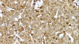 Anti-ZAP70 antibody [L453R] used in IHC (Paraffin sections) (IHC-P). GTX01960