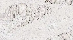 Anti-p63 antibody [7JUL] used in IHC (Paraffin sections) (IHC-P). GTX01961