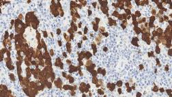 Anti-Nucleophosmin antibody [5A4] used in IHC (Paraffin sections) (IHC-P). GTX01967