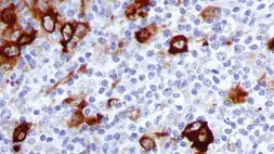 Anti-Fascin 1 antibody [IM20] used in IHC (Paraffin sections) (IHC-P). GTX01968