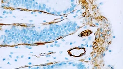 Anti-Caveolin 1 antibody [4D6] used in IHC (Paraffin sections) (IHC-P). GTX01969