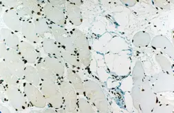 Anti-Emerin antibody [4G5] used in IHC (Paraffin sections) (IHC-P). GTX01975