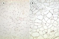 Anti-Utrophin antibody [DRP3/20C5] used in IHC (Frozen sections) (IHC-Fr). GTX01977
