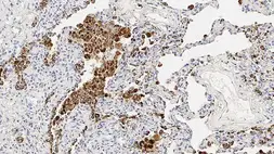 Anti-Napsin A antibody [IP64] used in IHC (Paraffin sections) (IHC-P). GTX01980