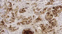 Anti-GCDFP15 antibody [23A3] used in IHC (Paraffin sections) (IHC-P). GTX01983