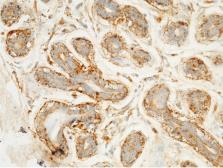 Anti-LAMP1 antibody [07] used in IHC (Paraffin sections) (IHC-P). GTX02073