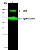 Anti-GOLPH2 antibody used in Immunoprecipitation (IP). GTX02179