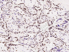 Anti-MEF2D antibody used in IHC (Paraffin sections) (IHC-P). GTX02187