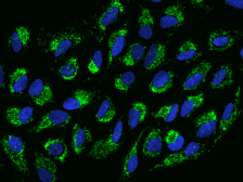 Anti-TUFM antibody used in Immunocytochemistry/ Immunofluorescence (ICC/IF). GTX02214