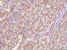 Anti-BNIP3L antibody used in IHC (Paraffin sections) (IHC-P). GTX02227