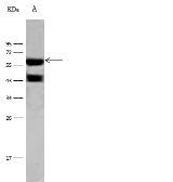 Anti-Cytokeratin 2 antibody used in Western Blot (WB). GTX02233