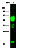 Anti-Carbonic Anhydrase XII antibody used in Western Blot (WB). GTX02237