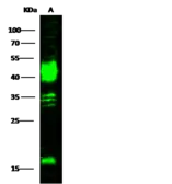Anti-Carbonic Anhydrase XII antibody used in Western Blot (WB). GTX02237