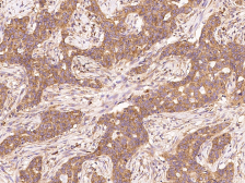 Anti-eEF1A1 antibody used in IHC (Paraffin sections) (IHC-P). GTX02242