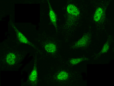 Anti-PSMB8 antibody used in Immunocytochemistry/ Immunofluorescence (ICC/IF). GTX02245