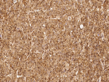 Anti-PSMB8 antibody used in IHC (Paraffin sections) (IHC-P). GTX02245