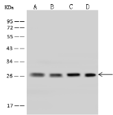 Anti-UBE2S antibody used in Western Blot (WB). GTX02251