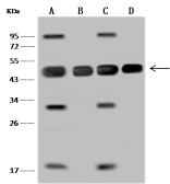 Anti-MEK2 antibody used in Western Blot (WB). GTX02266