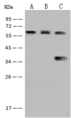 Anti-PCCB antibody used in Western Blot (WB). GTX02269