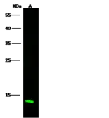 Anti-Profilin 2 antibody used in Western Blot (WB). GTX02270