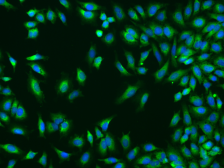 Anti-TROVE2 antibody used in Immunocytochemistry/ Immunofluorescence (ICC/IF). GTX02293