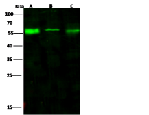Anti-PHGDH antibody used in Western Blot (WB). GTX02356