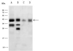 Anti-Cathepsin B antibody used in Western Blot (WB). GTX02413
