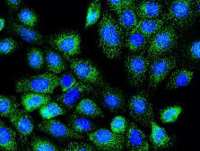Anti-RAB7A antibody used in Immunocytochemistry/ Immunofluorescence (ICC/IF). GTX02417