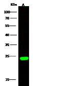 Anti-CTLA4 antibody used in Western Blot (WB). GTX02443