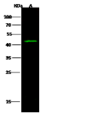 Anti-IDO1 antibody used in Western Blot (WB). GTX02444