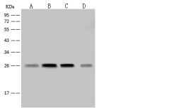 Anti-NDUFV2 antibody used in Western Blot (WB). GTX02504