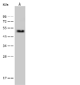 Anti-PSMC2 antibody used in Western Blot (WB). GTX02511