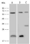 Anti-TROVE2 antibody used in Western Blot (WB). GTX02517