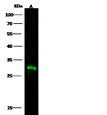 Anti-CTLA4 antibody used in Western Blot (WB). GTX02520