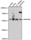 Anti-MAP3K8 antibody used in Western Blot (WB). GTX02525