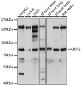 Anti-ODF2 antibody used in Western Blot (WB). GTX02526