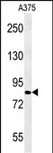 Anti-CPEB4 antibody used in Western Blot (WB). GTX02529