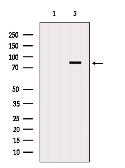 Anti-DDX17 antibody used in Western Blot (WB). GTX02534