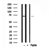 Anti-USP22 antibody used in Western Blot (WB). GTX02536