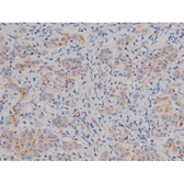 Anti-alpha Synuclein (phospho Ser129) antibody used in IHC (Paraffin sections) (IHC-P). GTX02537