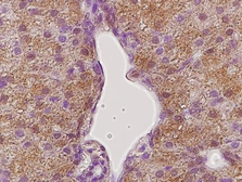 Anti-Growth hormone Receptor antibody used in IHC (Paraffin sections) (IHC-P). GTX02538
