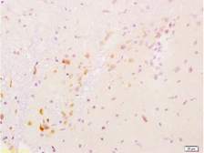 Anti-GDNF antibody used in IHC (Paraffin sections) (IHC-P). GTX02540