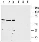 Anti-NTR1 antibody used in Western Blot (WB). GTX02541