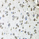 Anti-FGF1 antibody used in IHC (Paraffin sections) (IHC-P). GTX02555