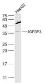 Anti-IGFBP3 antibody used in Western Blot (WB). GTX02574