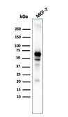 Anti-AKT1 antibody [AKT1/3898R] used in Western Blot (WB). GTX02584