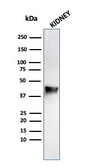 Anti-AMACR antibody [rAMACR/1864] used in Western Blot (WB). GTX02585